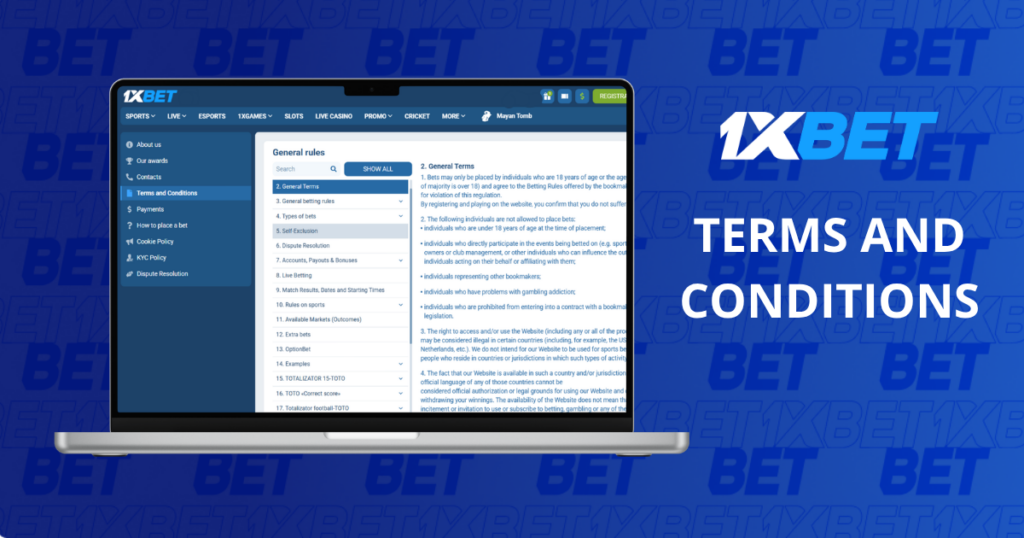 1xBet Terms and Conditions displayed on a laptop